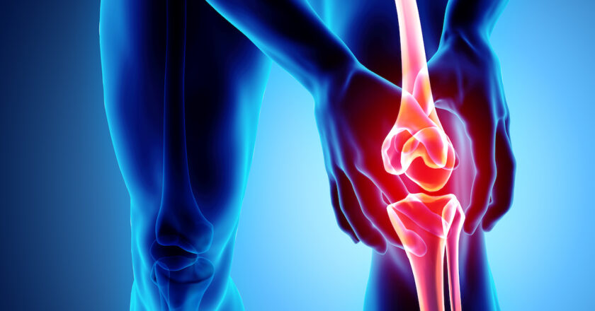 Arthritis: A common Degenerative Disorder