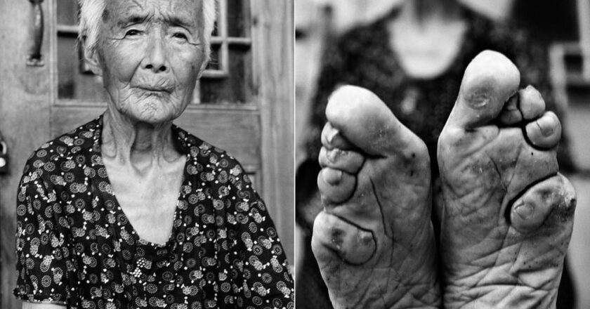 Lotus feet Tradition: Standard of beauty or a barbaric act