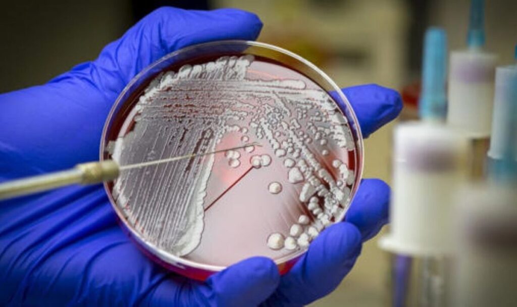 Canadian researchers developed a new antibiotic using AI to kill Superbug