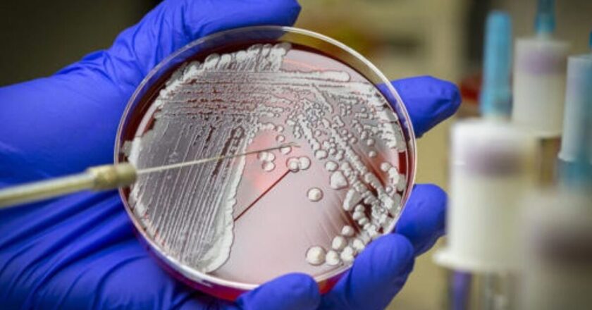Canadian researchers developed a new antibiotic using AI to kill Superbug